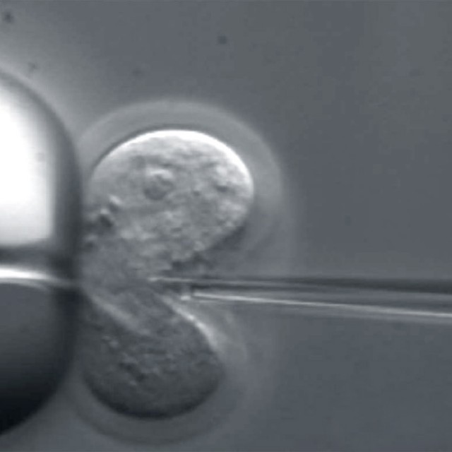 Biomaterials / Mechanobiology